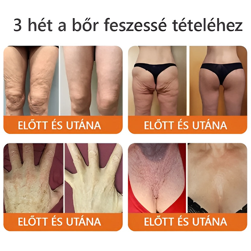 ✅ Bőrgyógyász ajánlása ✨ ZödVita® Méhméreg Bőr Helyreállító Krém 🔥 Magyar fejlesztés, magyarországi gyártás és szállítás