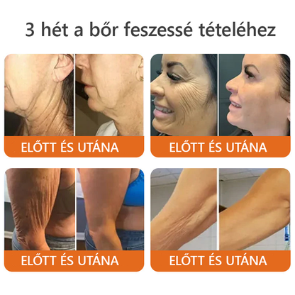 ✨ Bőrgyógyász ajánlása ✨ ZödVita® Méhméreg Bőr Helyreállító Krém 🔥 Magyar fejlesztés, magyarországi gyártás és szállítás