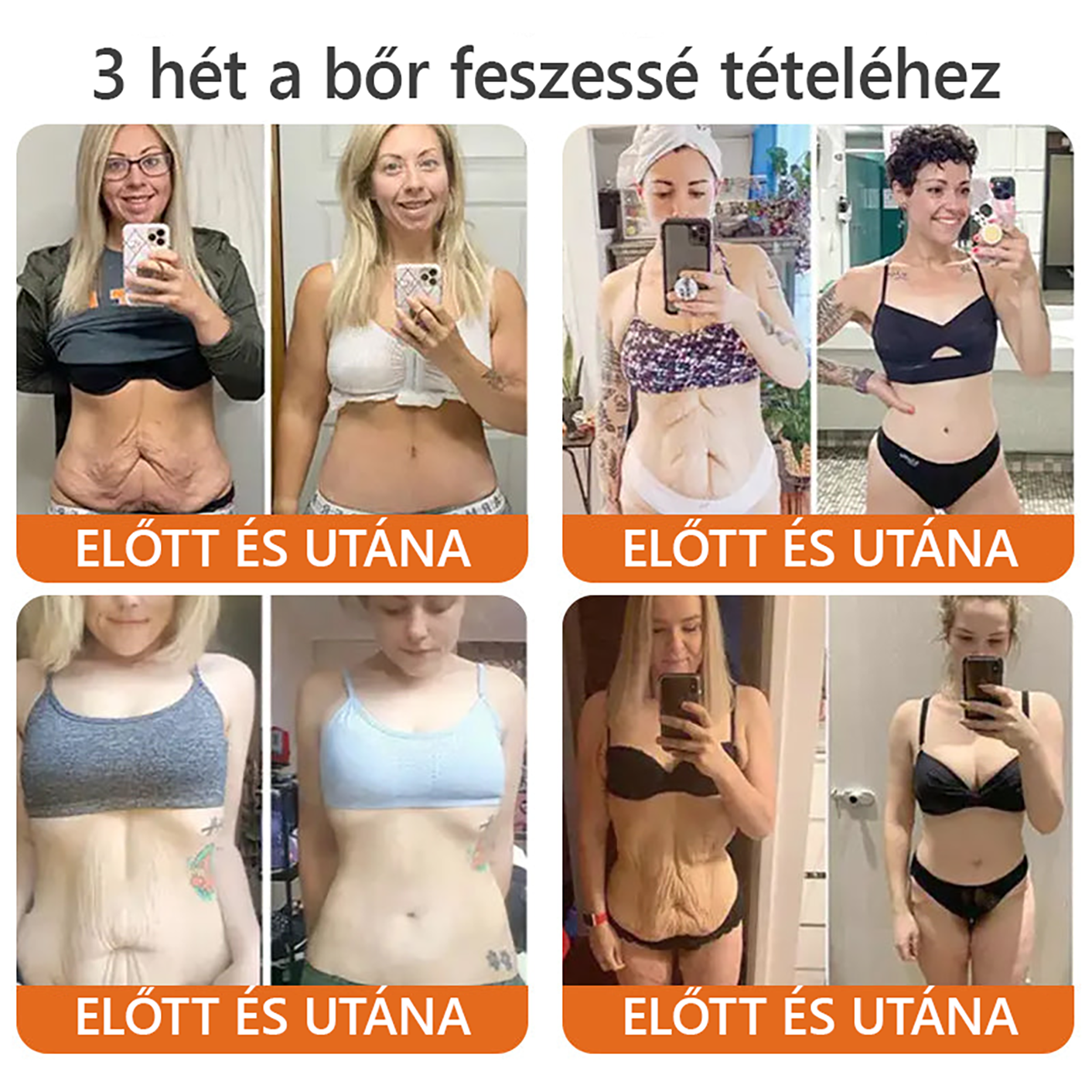 ✅ Bőrgyógyász ajánlása ✨ ZödVita® Méhméreg Bőr Helyreállító Krém 🔥 Magyar fejlesztés, magyarországi gyártás és szállítás