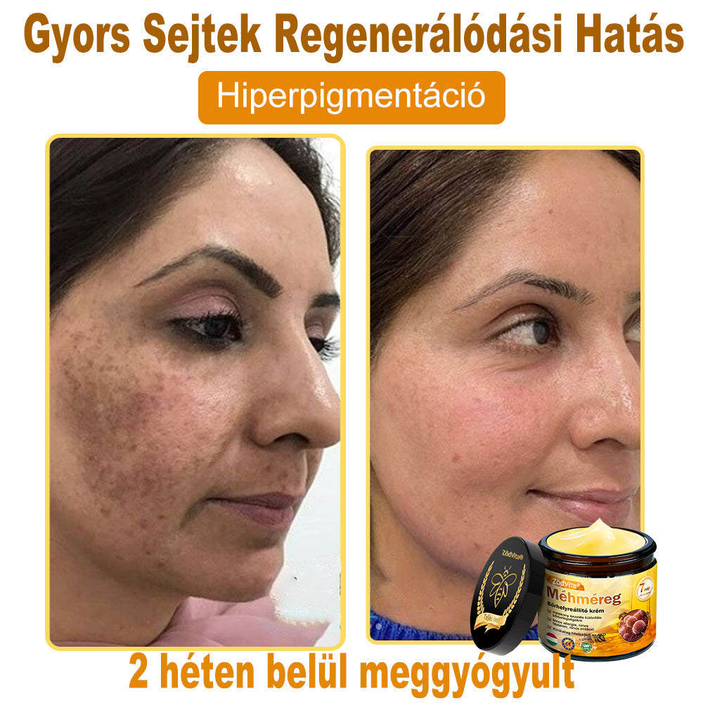 ✅ Bőrgyógyász ajánlása ✨ ZödVita® Méhméreg Bőr Helyreállító Krém 🔥 Magyar fejlesztés, magyarországi gyártás és szállítás