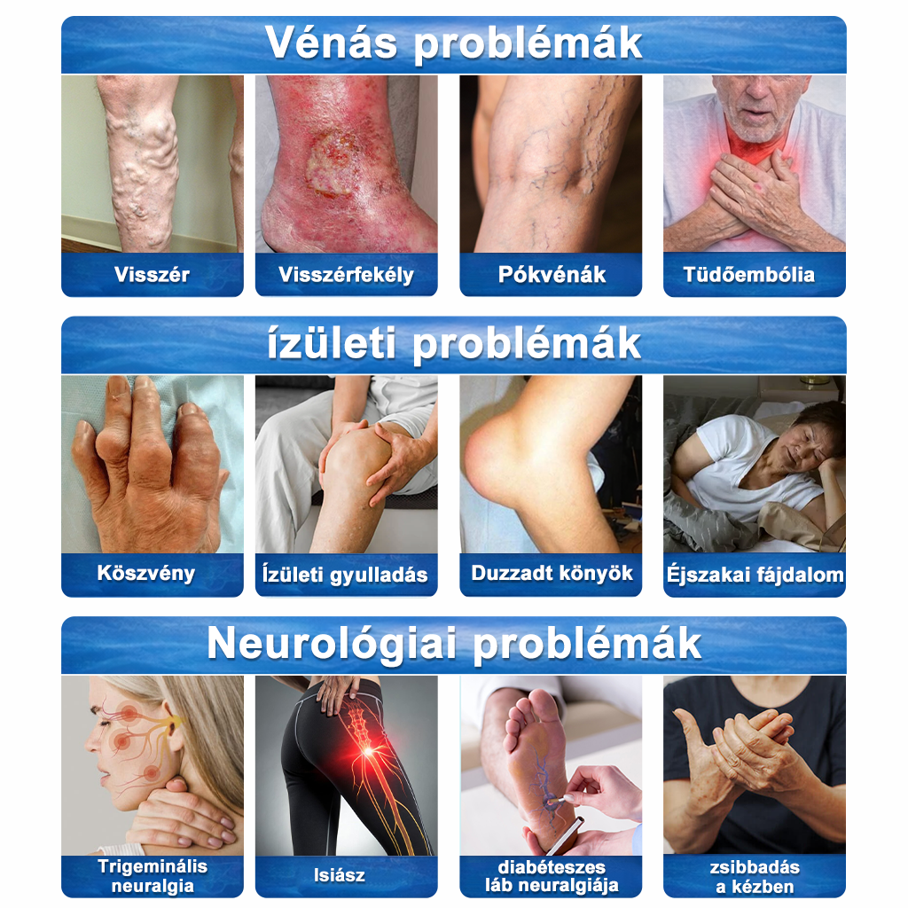✨ Medistart® 3 az 1-ben regeneráló krém Egy kenés, három hatás – 7 nap alatt véget vet az ízületi fájdalomnak, idegfájdalomnak és visszérnek