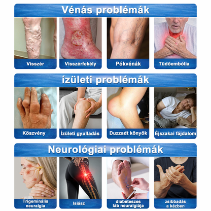 ✨ Medistart® 3 az 1-ben regeneráló krém Egy kenés, három hatás – 7 nap alatt véget vet az ízületi fájdalomnak, idegfájdalomnak és visszérnek