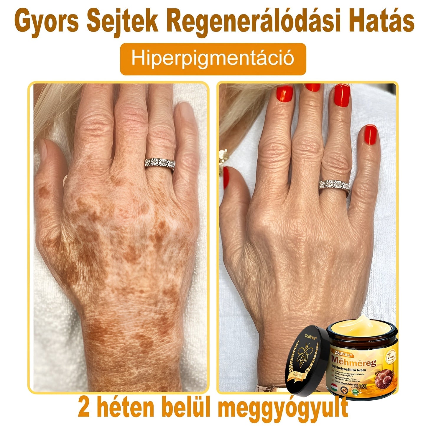 ✅ Bőrgyógyász ajánlása ✨ ZödVita® Méhméreg Bőr Helyreállító Krém 🔥 Magyar fejlesztés, magyarországi gyártás és szállítás