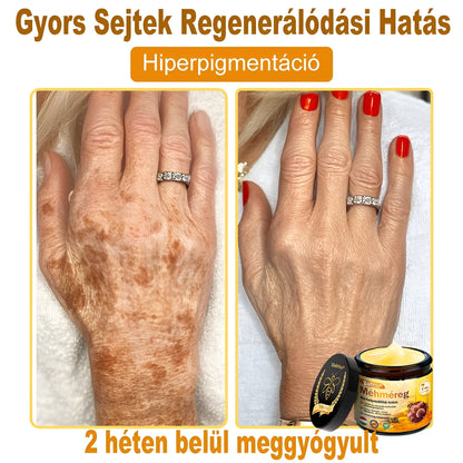 ✅ Bőrgyógyász ajánlása ✨ ZödVita® Méhméreg Bőr Helyreállító Krém 🔥 Magyar fejlesztés, magyarországi gyártás és szállítás