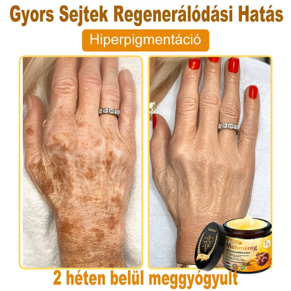 ✨ Bőrgyógyász ajánlása ✨ ZödVita® Méhméreg Bőr Helyreállító Krém 🔥 Magyar fejlesztés, magyarországi gyártás és szállítás