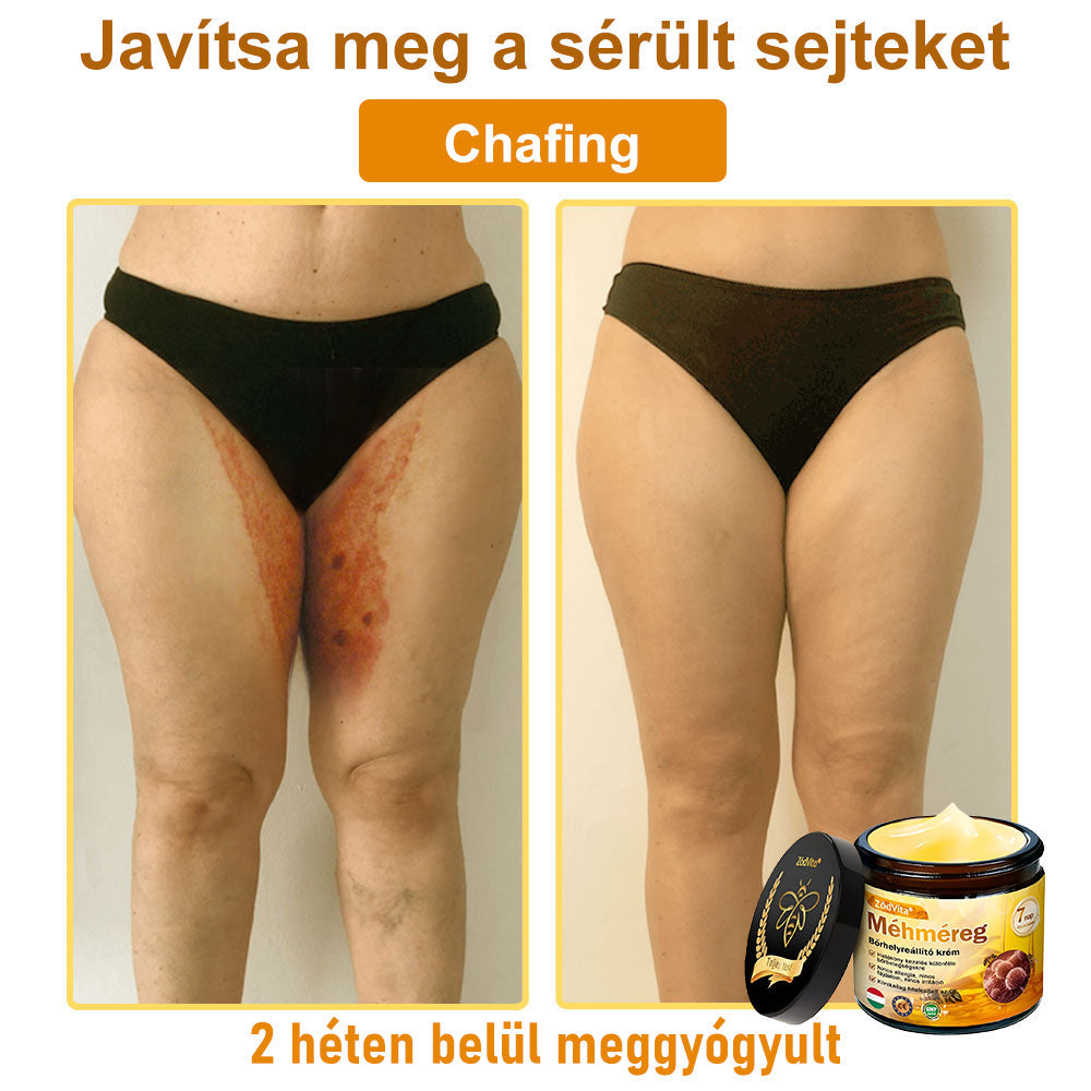 ✨ Bőrgyógyász ajánlása ✨ ZödVita® Méhméreg Bőr Helyreállító Krém 🔥 Magyar fejlesztés, magyarországi gyártás és szállítás