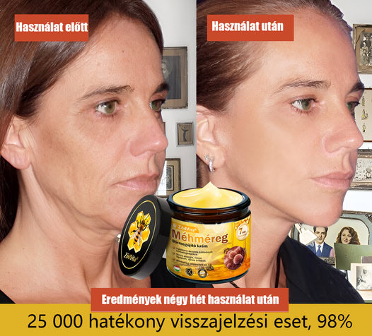 ✅ Bőrgyógyász ajánlása ✨ ZödVita® Méhméreg Bőr Helyreállító Krém 🔥 Magyar fejlesztés, magyarországi gyártás és szállítás