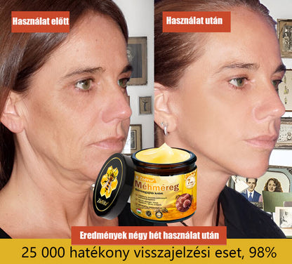 ✅ Bőrgyógyász ajánlása ✨ ZödVita® Méhméreg Bőr Helyreállító Krém 🔥 Magyar fejlesztés, magyarországi gyártás és szállítás