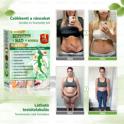 🏆🏆 BSWELL® Nano mikrotűs karcsúsító tapasz
