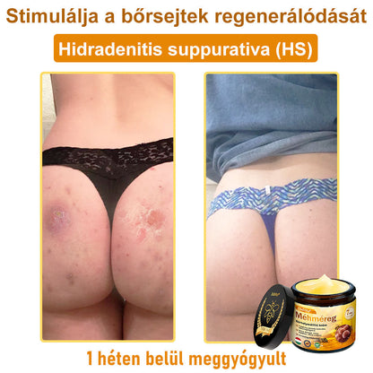 ✨ Bőrgyógyász ajánlása ✨ ZödVita® Méhméreg Bőr Helyreállító Krém 🔥 Magyar fejlesztés, magyarországi gyártás és szállítás