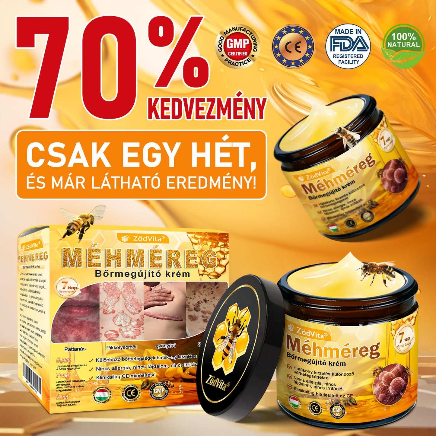 ✅ Bőrgyógyász ajánlása ✨ ZödVita® Méhméreg Bőr Helyreállító Krém 🔥 Magyar fejlesztés, magyarországi gyártás és szállítás